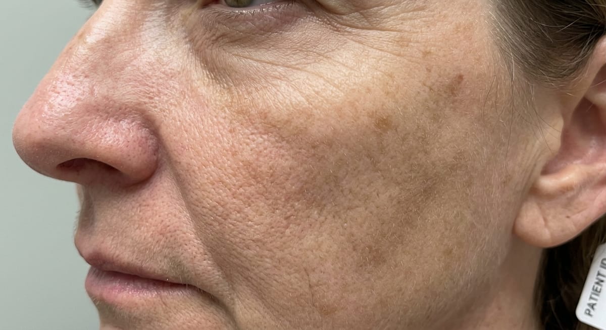 До: Фотостарение