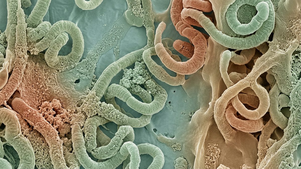 Актинический кератоз (обзор литературы)